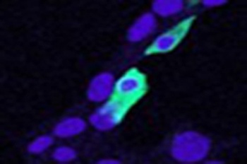 GAB2 Antibody