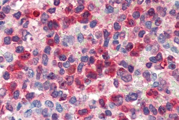 G6PD Antibody