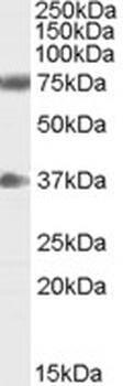 IKZF1 Antibody