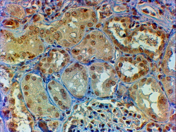 FH Antibody