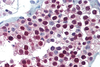 FOXP2 Antibody