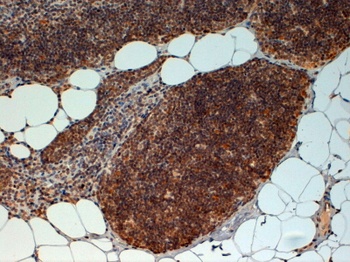 FOXN1 Antibody