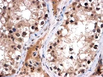 FOXI1 Antibody