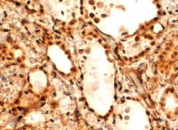 FOXE1 Antibody