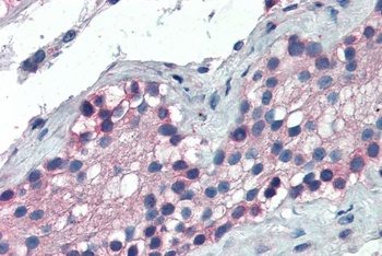 FOXE1 Antibody