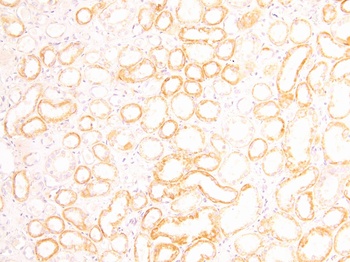FOXD1 Antibody