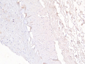 FOXD1 Antibody