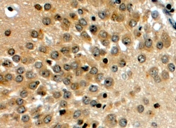 FOXC1 Antibody