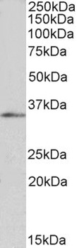 FOXB1 Antibody