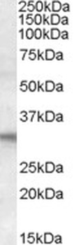 FHL2 Antibody