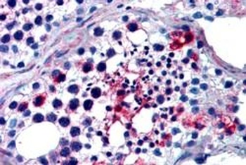 FHL1 Antibody
