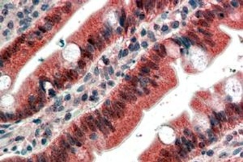 FGFR1 Antibody