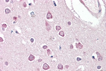 FGF23 Antibody