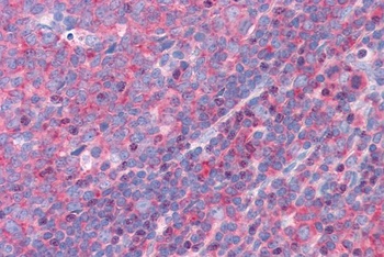 FNBP1 Antibody