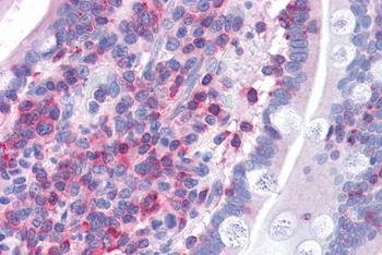 FNBP1 Antibody