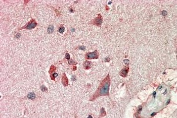 FBL2 Antibody