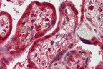 PLEKHA8 Antibody