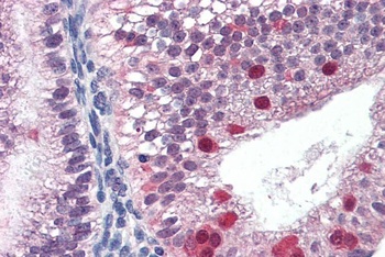 FANCG Antibody