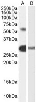 ZMPSTE24 Antibody