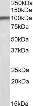 FABP2 Antibody