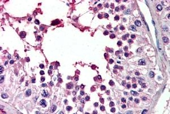 FABP2 Antibody