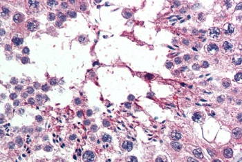 XPO7 Antibody