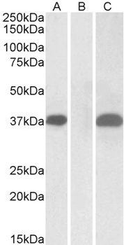 ERG Antibody