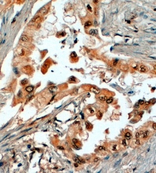 EPM2AIP1 Antibody