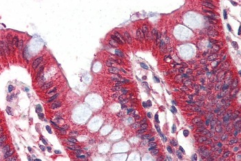 PTPN6 Antibody