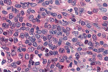 PTGER1 Antibody