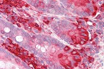 EndoPDI Antibody