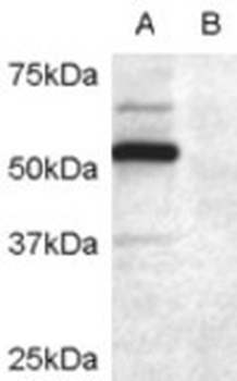 EIF2C1 Antibody