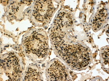 UBR5 Antibody