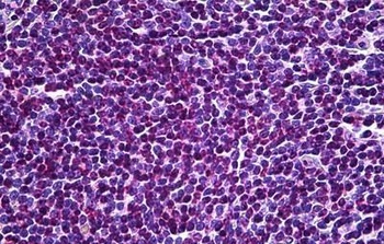 UBR5 Antibody