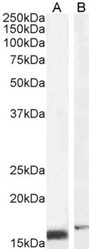 DYX1C1 Antibody