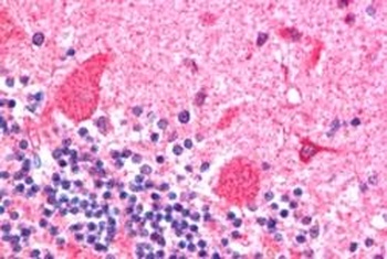 Dynactin Antibody