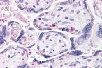 DUSP16 Antibody