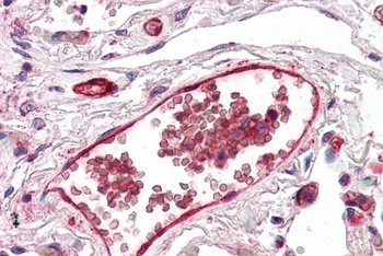 Duffy Antibody