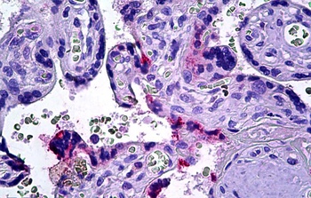 DOK3 Antibody