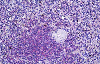 DOK3 Antibody