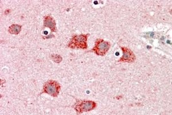 DKK3 Antibody