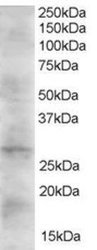 DKK2 Antibody