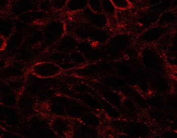 DISP1 Antibody