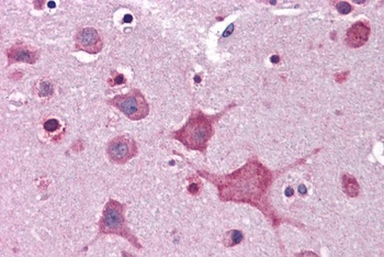 Dipeptidylpeptidase 10 Antibody