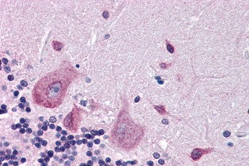 Dipeptidylpeptidase 10 Antibody