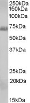 DGAT1 Antibody
