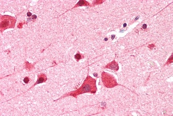 DDX6 Antibody