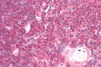 DDX6 Antibody
