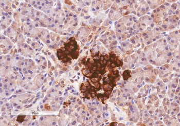 DDX6 Antibody