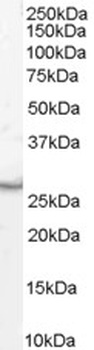 DCP1A Antibody